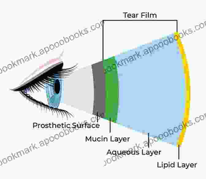 Diagram Of The Tear Film Layers A Passage Into The Eye: Understanding Of The Eye From Tear Film To Photoreceptors With An Application Of Optical Coherence Tomography (OCT)