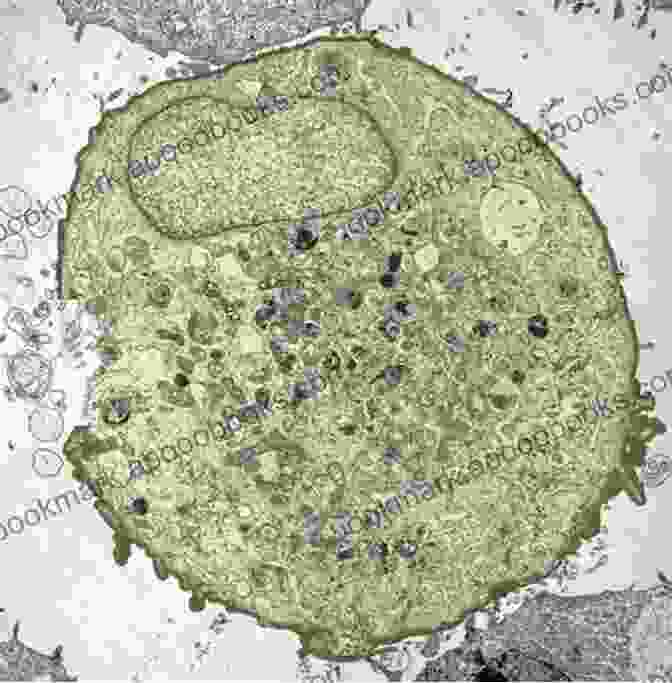 Microscopic Image Of A Cell Cerebrovascular Abnormalities: A Atlas Of Macroscopic And Microscopic Aspects Research